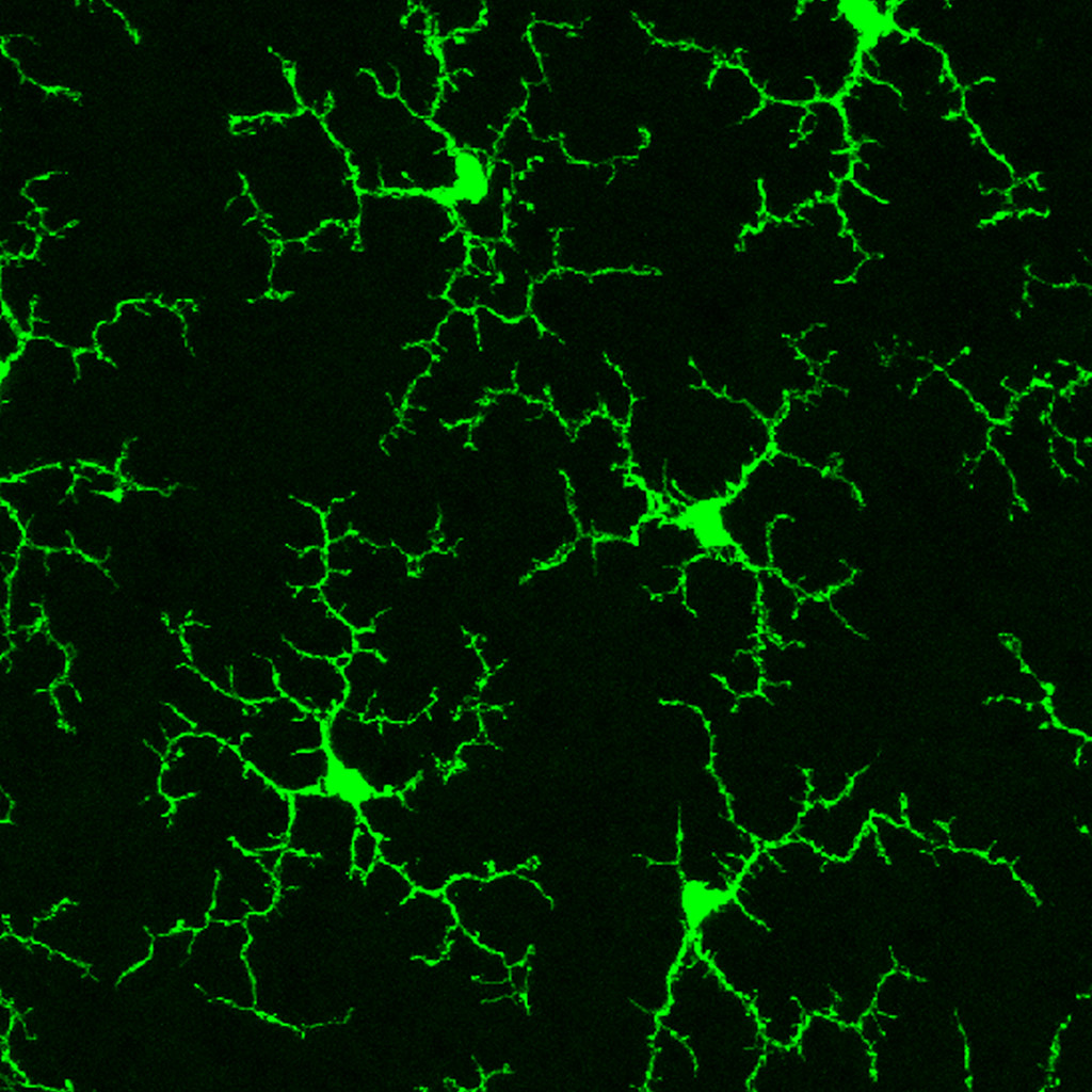 Microglia in a Healthy Adult Mouse Retina — Photo by National Institutes of Health (NIH)