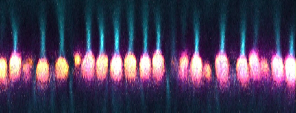Cone mitochrondia — Photo by National Institutes of Health (NIH)